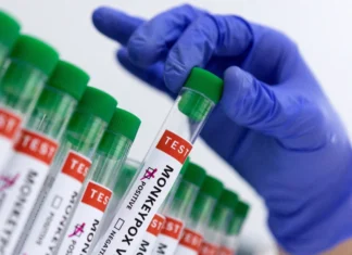 África registra más de 42,300 casos y 1,100 muertes por mpox en 18 países