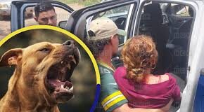 Una mujer sobrevive al violento ataque de sus propios perros pitbull en La Unión, Olancho