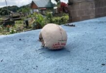 ¡Horror! Encuentran cráneo humano con un nombre escrito sobre una tumba en Tocoa