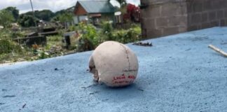 ¡Horror! Encuentran cráneo humano con un nombre escrito sobre una tumba en Tocoa