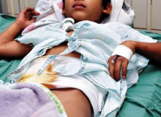 FUNDANIQUEM reporta que alrededor de 12 menores han sido víctimas que quemaduras por pólvora en 2024