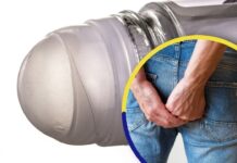 ¡Insólito! Un hombre fue atendido de emergencia en San Lorenzo, Valle, porque llevaba «un desodorante en el ano»