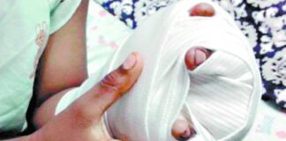 Un niño de 7 años pierde dos dedos al manipular pólvora durante la Nochebuena