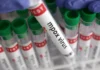 China confirma su primer brote de la nueva variante de la mpox