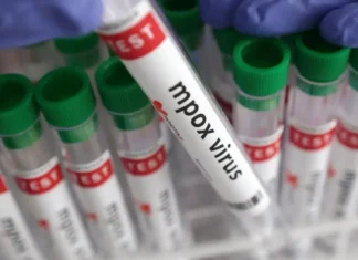 China confirma su primer brote de la nueva variante de la mpox