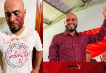 Atentan contra precandidato a la alcaldía de Mangulile, Olancho