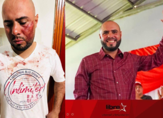 Atentan contra precandidato a la alcaldía de Mangulile, Olancho