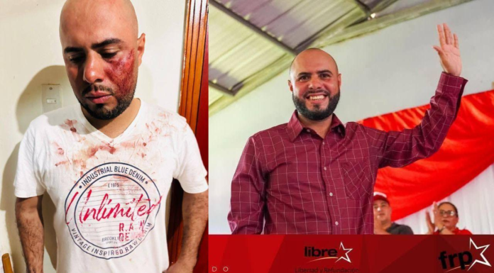 Atentan contra precandidato a la alcaldía de Mangulile, Olancho