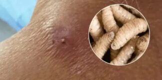 Honduras registra mil 820 casos de gusano barrenador en ganado y 82 en humanos