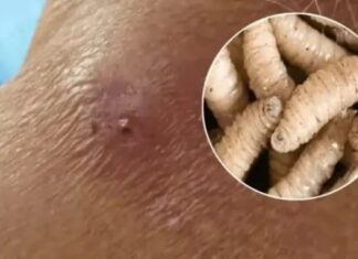 Honduras registra mil 820 casos de gusano barrenador en ganado y 82 en humanos