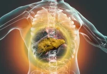 Un estudio vincula el consumo de alcohol con una mayor incidencia del cáncer de páncreas