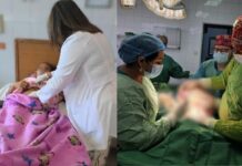 Extirpan quiste de hasta 20 libras a mujer de 64 años en el Hospital Escuela; abdomen parecía de cinco meses de embarazo