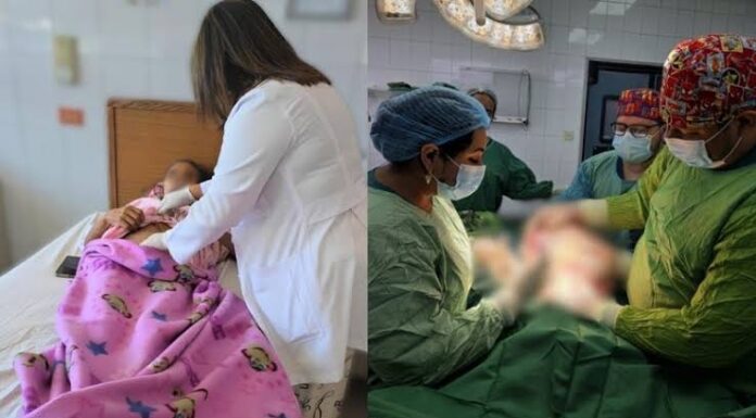Extirpan quiste de hasta 20 libras a mujer de 64 años en el Hospital Escuela; abdomen parecía de cinco meses de embarazo